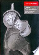 libro Choque Femoroacetabular